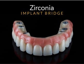 zirconia implant bridge